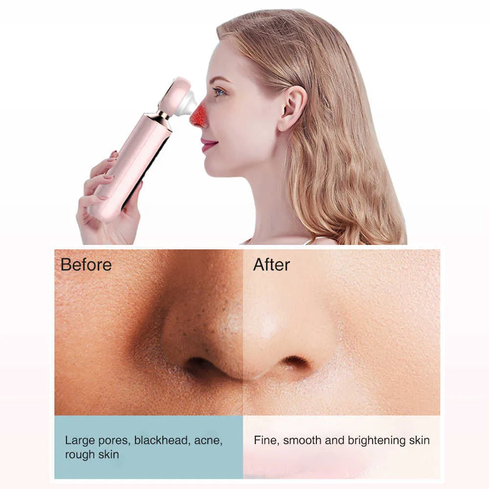 TRENDY FINDS HAVEN™ Blackhead Suction Machine جهاز شفط الرؤوس السوداء TRENDY FINDS HAVEN™