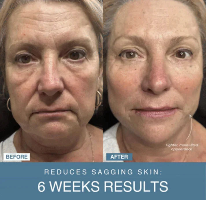 TRENDY FINDS HAVEN™ 7-in-1 LED Anti-Aging & Wrinkle Apparatus جهاز TRENDY FINDS HAVEN™ 7 في 1 لمكافحة التجاعيد وعلامات التقدم بالسن