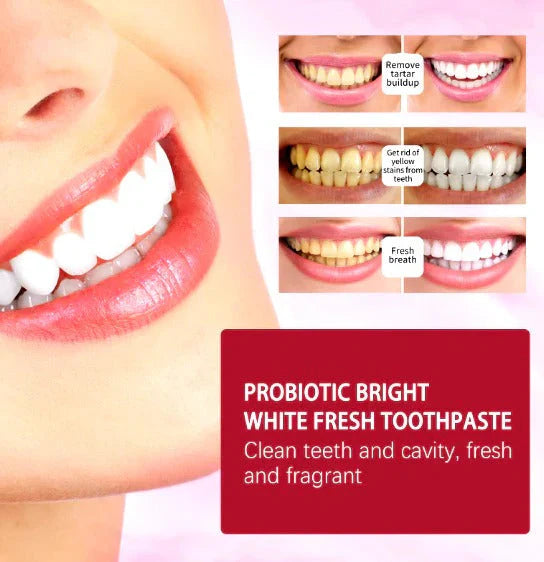 TRENDY FINDS HAVEN™ Sp-4 Toothpaste – معجون الأسنان Sp-4