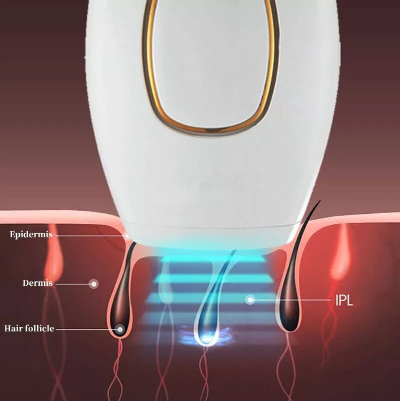 TRENDY FINDS HAVEN™ IPL Laser Hair Removal – جهاز إزالة الشعر بالليزر IPL